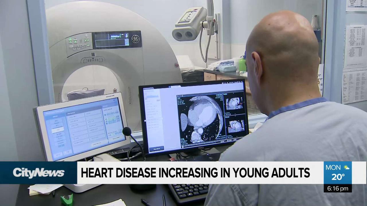 heart-disease-increasing-in-younger-people-citynews-vancouver