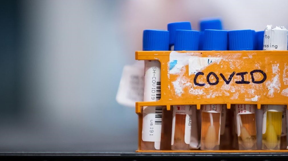 COVID-19 test vials are held together in an orange case with the word COVID written in black marker on the front