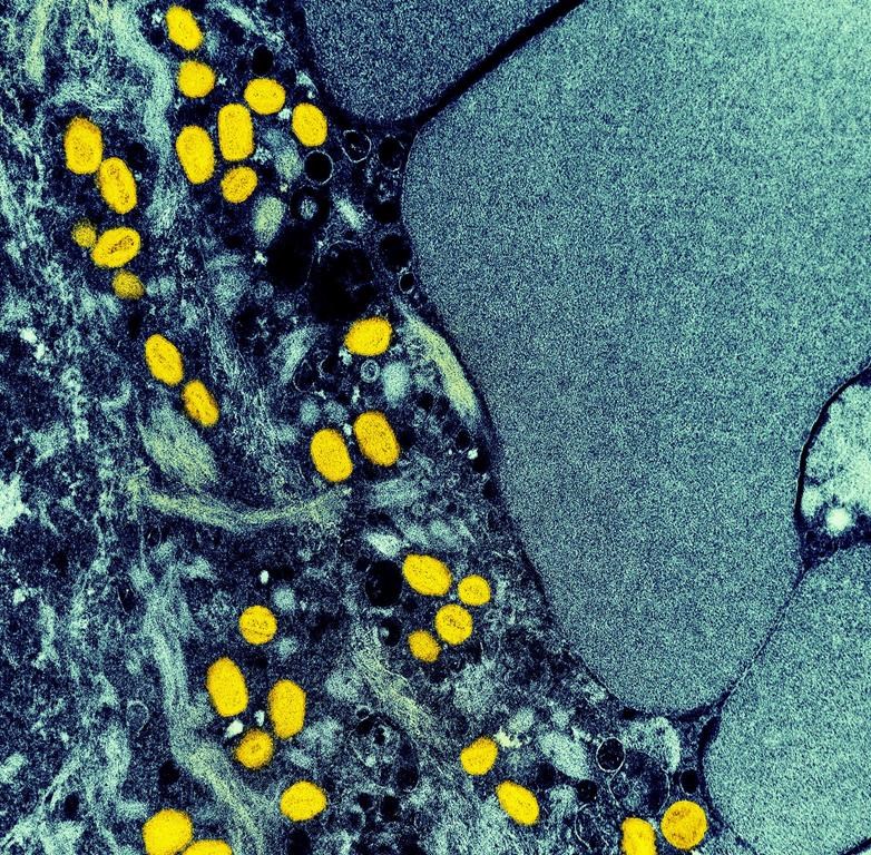 A photograph of virus-infected cells on a micro scale