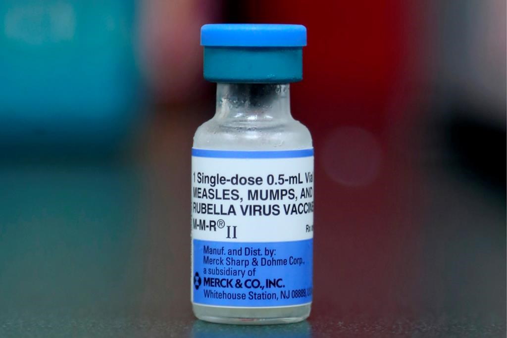 Ensure you're vaccinated against measles: B.C. health minister